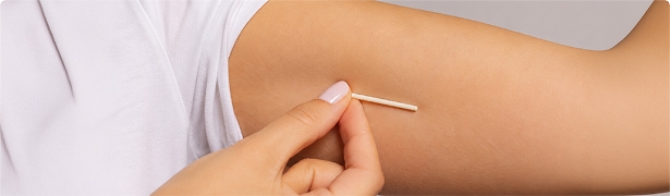 A contraceptive implant being inserted beneath the skin of an arm